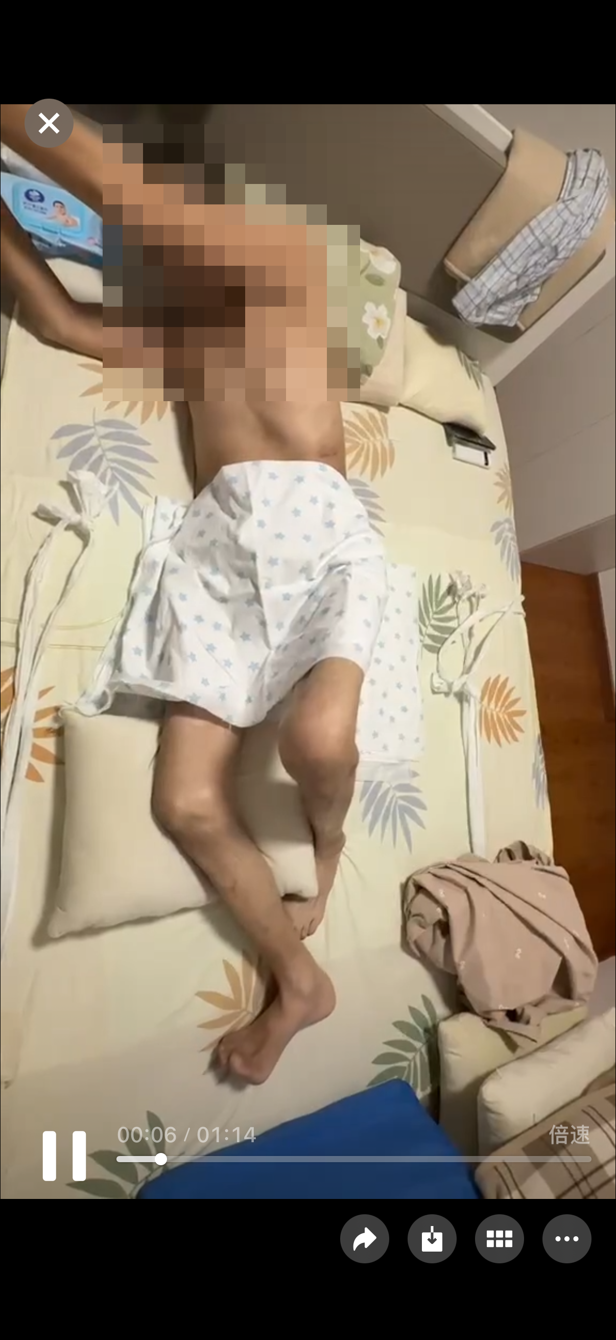 Pelvic Fracture Rescue