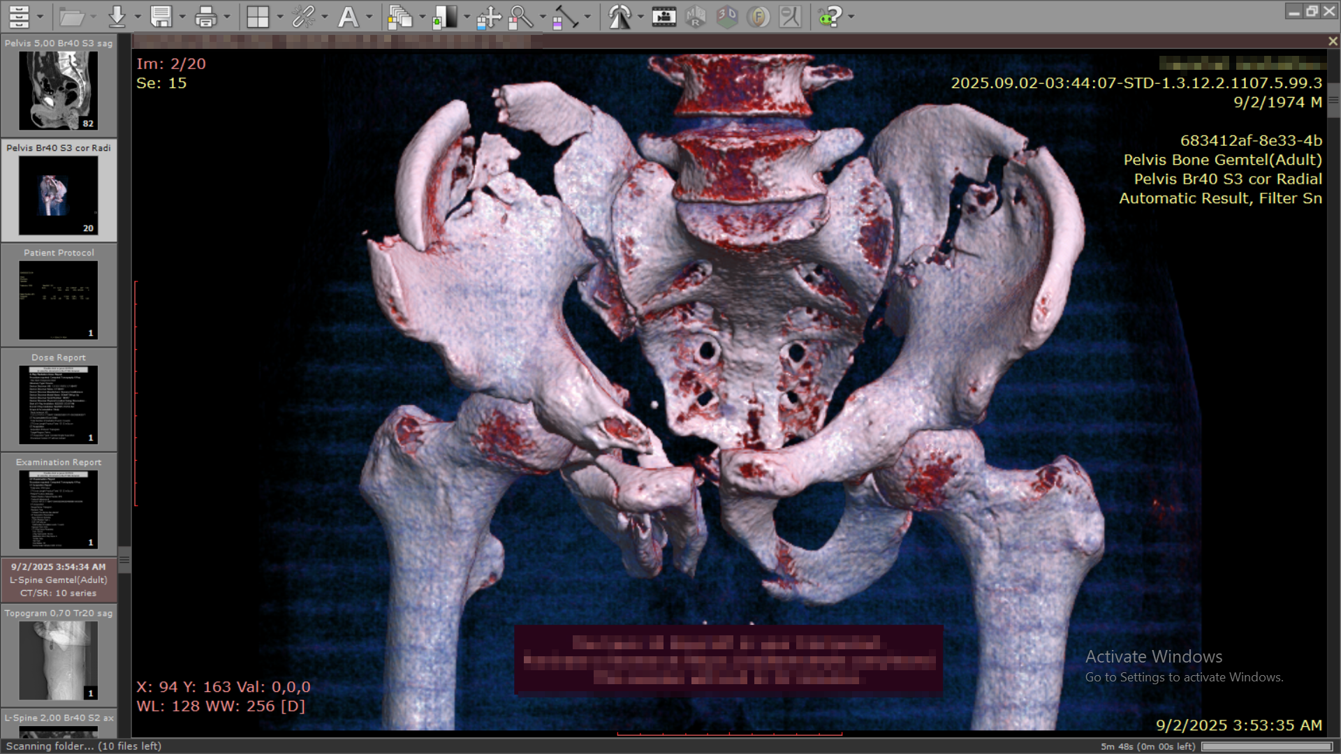Pelvic Fracture Rescue supporting image 5