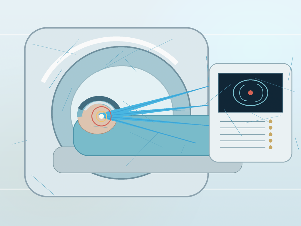 Magnetic Resonance Knife